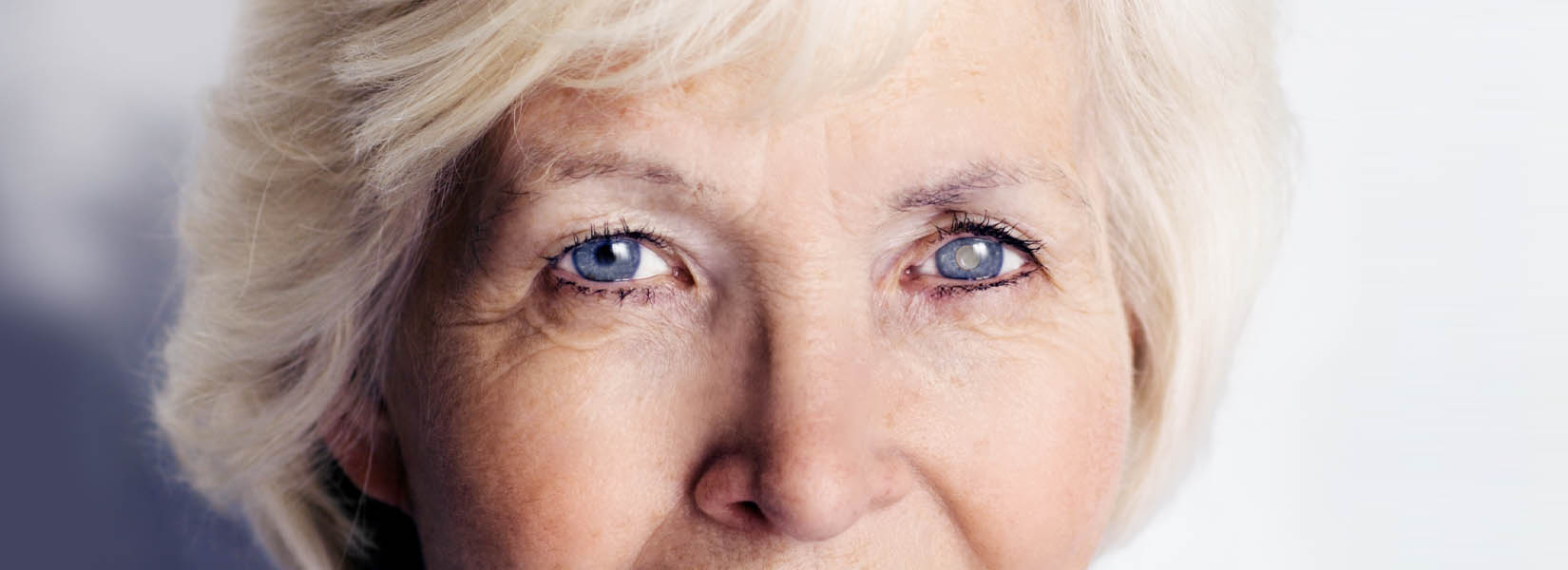 Cataract Surgery in Evanston